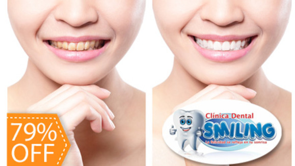 [Imagen:¡Paga $75 en lugar de $350 por Blanqueamiento Dental con Luz LED + Limpieza Dental con Ultrasonido + Aplicación de Desensibilizante + Aplicación de Flúor en Clínica Dental Smiling!]