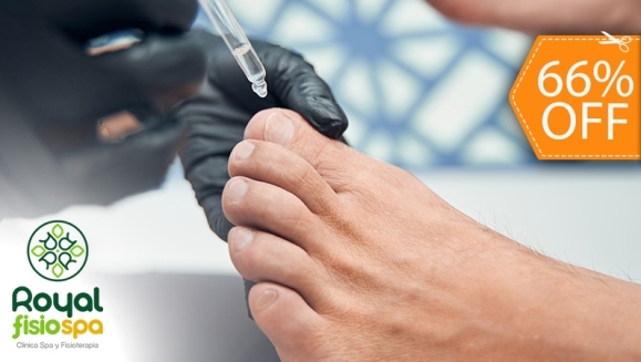 [Imagen:¡Nueva Técnica! ¡Paga $45 en Lugar de $133.32 por 2 Sesiones para Eliminar Hongos Hasta en 5 Uñas que Incluye: 2 Aplicaciones de Ácido + 2 Pedicures Clínicos + Diagnóstico Profesional!]