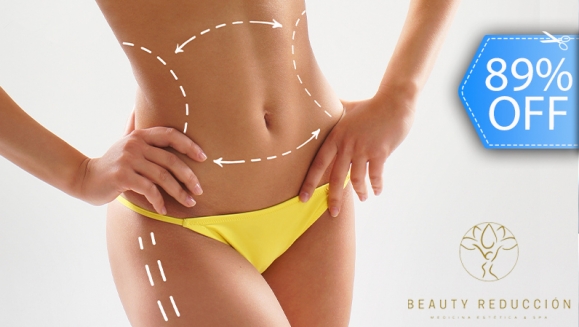 [Imagen:¡Paga Q499 en Lugar de Q4,500 por Circuito Reductivo Intensivo en 4 Áreas: Abdomen y Laterales Espalda Baja y Brazos: Mesoterapias, Masajes, Lipo Lasers, Ultracavitaciones, Vacumterapias y Más!]