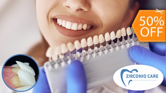 [Imagen:¡Paga $62.50 en Lugar de $125 por Carilla Dental de Cerómero + Limpieza Dental con Ultrasonido!]