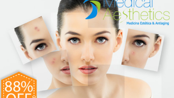 [Imagen:¡Paga Q149 en lugar de Q1200 por Paquete Facial de Lujo que incluye: 1 Microdermoabrasión con Punta de Diamante + Peeling Enzimático + Exfoliación + Altafrecuencia + Mascarilla Relajante e Hidratante + Protector Solar en Medical Aesthetics!]