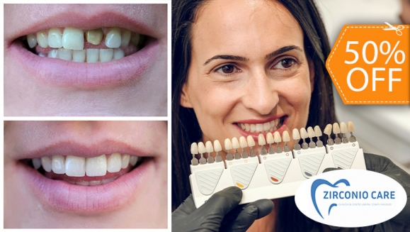 [Imagen:¡Mejora la Forma y el Color de tu Sonrisa! ¡Paga $62.50 en Lugar de $125 por Carilla Dental de Cerómero + Limpieza Dental con Ultrasonido!]