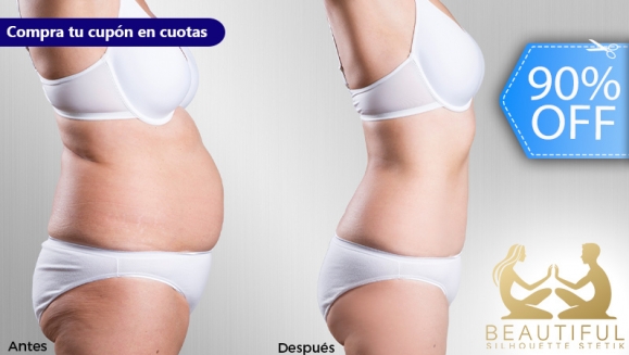 [Imagen:¡Nueva Figura en 4 Semanas! ¡Paga Q399 en Lugar de Q4,199 por un Pack de 150 Tratamientos Reductores Intensivos y con Acción Anti-Obesidad Localizada para Cuerpo Completo!]
