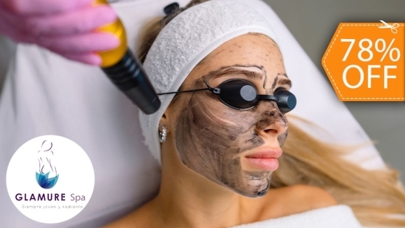 [Imagen:¡Adiós Poros Dilatados! ¡Paga $19 en Vez de $85 por Facial de Rejuvenecimiento “Hollywood Peel” con Microdermoabrasión con Punta de Diamante + Aplicación de Láser + Mascarilla de Carbón Activado + Extracción de Puntos Negros + Exfoliación y Más!]
