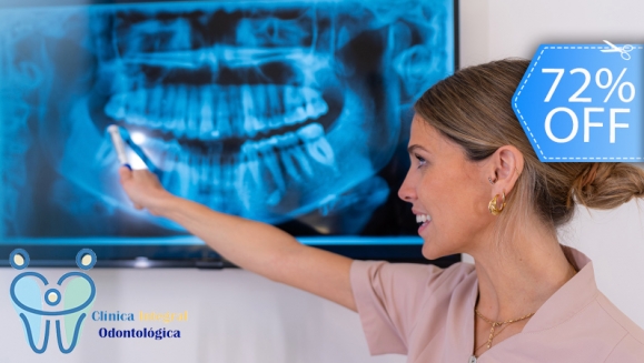 [Imagen:¡Paga Q99 en Lugar de Q350 por Radiografía Panorámica Digital + Evaluación Dental Completa + Creación de Plan de Tratamiento!]