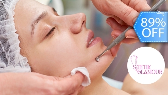 [Imagen:¡Paga Q99 en vez de Q900 por 2 Sesiones de Limpieza Facial Profunda con Microderm-Vacum + Radiofrecuencia + Máscara LED + Extracción de Puntos Negros + Exfoliación + Mascarilla de Arcilla o Carbón Activado + Vitamina E + Bloqueador Solar!]