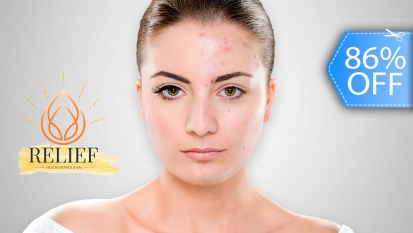 [Imagen:¡Paga Q99 en Lugar de Q700 por Facial Antiacné con Extracción de Comedones + Alta Frecuencia + Mascarilla LED + Exfoliación + Vapor con Ozono + Limpieza Purificante + Tónico + Mascarilla Anti Acné + Arcilla Verde + Carbón Activado y Más!]