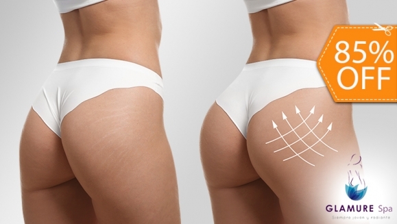[Imagen:¡Paga $24 en Lugar de $160 y Levanta, Moldea y Tonifica Tus Glúteos con 4 Rellenos + 4 Levantamientos + 4 Redondeos + 2 Tonificadores + 4 Alisamientos de Piel + 4 Moldeos de Espalda + 4 Moldeos de Cintura + 1 Cinturón Térmico!]