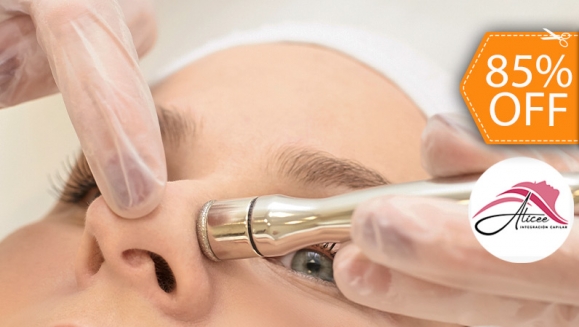 [Imagen:¡Paga $20 en Lugar de $130 por 2 Sesiones de Limpieza Facial Profunda con: 2 Microdermoabrasiones con Punta de Diamante + 2 Alta Frecuencias + 2 Limpiezas Faciales con Extracción de Puntos Negros + 2 Sesiones de Vapor de Ozono y Más!]