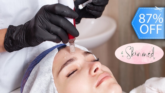 [Imagen:¡Paga Q199 en Lugar de Q1,500 por Sesión de Dermapen con Cóctel de Ácido Hialurónico, Argireline y Vitaminas E y C!]