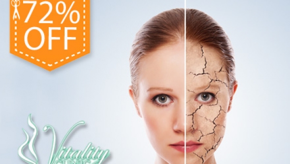 [Imagen:¡Paga Q125 en vez de Q450 por Paquete Facial que incluye: Microdermoabrasión + Peeling Enzimático + Exfoliación + Vaporización + Vacumterapia + Mascarilla Pevonia +Serum de Vitamina C + Cremas Finales + Masaje en Rostro y Manos en Vitality Clinic!]