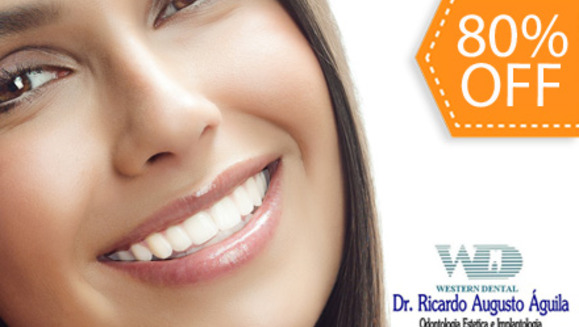 [Imagen:¡Paga $30 en lugar de $150 por 2 Rellenos Estéticos de Resina Blanca o 4 Sellantes de Fosas y Fisuras + Diagnóstico Buco-Dental + Limpieza con Ultrasonido + Aplicación de Flúor en la Lujosa Sala VIP de Western Dental San Benito!]