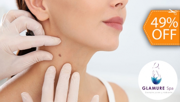 [Imagen:¡Paga $18 en Lugar de $35 por Electrocauterización de Hasta 20 Verrugas!]