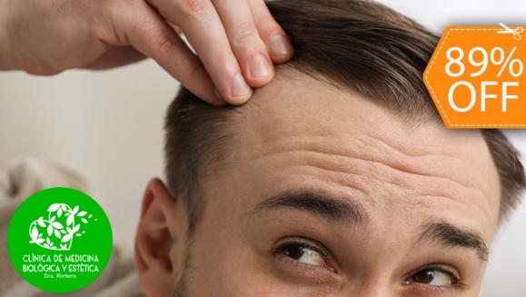 [Imagen:¡Paga $50 en Lugar de $435 por 3 Sesiones de Tratamiento Capilar Para Combatir la Calvicie!]