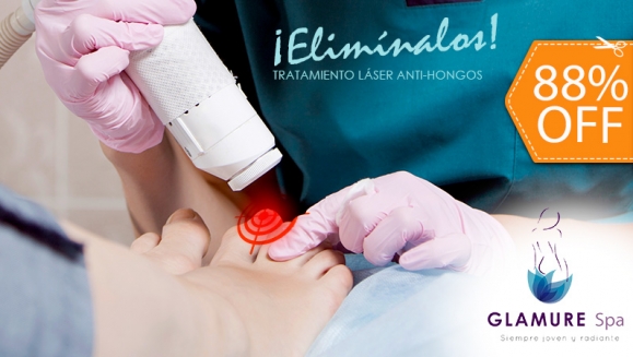 [Imagen:¡Paga $10 en Lugar de $80 por 1 Sesión Láser para 2 Uñas con Hongo + Evaluación Médica!]