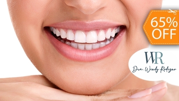 [Imagen:¡Paga $55 en Lugar de $155 por 2 Aplicaciones de Blanqueamiento Dental con Luz LED en 1 Sola Sesión + Limpieza Dental!]