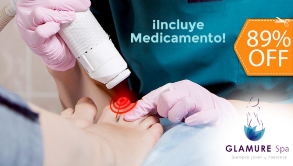 [Imagen:¡Paga $10 en Lugar de $90 por Sesión Láser para 2 Uñas con Hongo + Medicamento para Combatir la Onicomicosis (30 ml) + Evaluación Médica!]