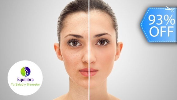 [Imagen:¡Paga Q199 en Lugar de Q2,800 por Rejuvenecimiento y Relleno Facial para Eliminar Arrugas, Líneas de Expresión y Cicatrices que Incluye: Rellenos con Células Madre, Aplicación de Enzimas Plaquetarias, Estiramiento, Tensado Facial y Más!]