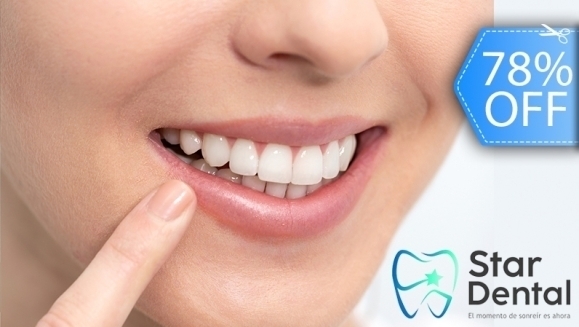 [Imagen:¡Paga Q395 en Lugar de Q1,800 por Blanqueamiento Dental Químico con Luz LED + Remoción de Manchas con Profilaxis + Limpieza con Ultrasonido +  Evaluación Completa con Plan de Tratamiento incluido!]