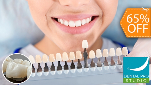 [Imagen:¡Recupera tu Sonrisa! ¡Paga $78 en Lugar de $225 por 1 Corona Dental (Metal Porcelana) + Profilaxis Manual (Pulido y Limpieza) + 1 Tono de Blanqueamiento Dental!]