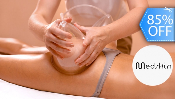 [Imagen:¡Paga Q299 en Lugar de Q2,000 por 21 Tratamientos para Tonificar Glúteos: 6 Copas de Vacío Delfín con Radiofrecuencias + 6 Copas Suecas + 6 Masajes Drenantes + 3 Mesoterapias con Vitamina C!]