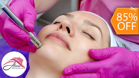 [Imagen:¡Paga $20 en Lugar de $130 por 2 Sesiones de Limpieza Facial Profunda con: 2 Microdermoabrasiones con Punta de Diamante + 2 Altas Frecuencias + 2 Limpiezas Faciales con Extracción de Puntos Negros + 2 Sesiones de Vapor de Ozono y Más!]