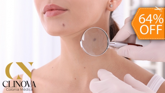 [Imagen:¡Paga $18 en Lugar de $50 por Eliminación de Hasta 15 Verrugas,  Acrocordones, Mezquinos o Cabezas de Vena con Plasma Pen o Electrocauterización + Consulta Médica!]