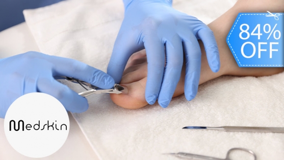 [Imagen:¡Paga Q125 en Lugar de Q800 por Pedicure Médico que Incluye: Limpieza + Extracción + Aplicación de Medicamento Clínico para Uñas Encarnadas, con Onicomicosis, Hongos u Otras Afecciones + Evaluación + Instrucciones de Seguimiento!]