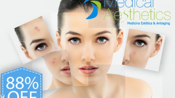 [Imagen:¡Paga Q199 en lugar de Q1600 por Paquete Facial PRE VERANO que incluye: 2 Microdermoabrasiones  + 2 Peeling Iluminadores de Vitimina C + 2 Exfoliaciones de Vitamina C y Toronja y más en Medical Aesthetics!]