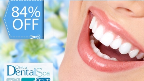 [Imagen:¡Paga Q395 en lugar de Q2400 por paquete que incluye: Blaqueamiento Láser + Pulido de Superficies Dentales con Profijet + Limpieza Profunda con Ultrasonido + Examen completo y Evaluación con Cámara Intraoral en Dental Spa!]