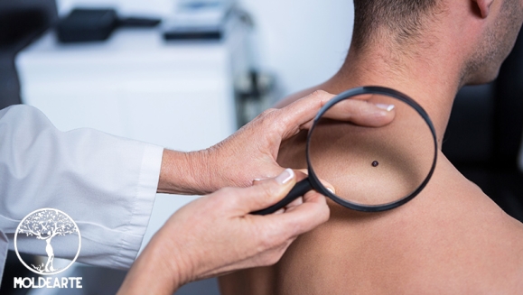 [Imagen:¡Oferta Exclusiva por Apertura de Nueva Sucursal! ¡Paga Q49 en Lugar por Q350 por 1 Servicio a Elección entre Cauterización de Lunares o Limpieza Facial Profunda o Masaje Detox! ¡UNICAMENTE POR 7 DIAS!]