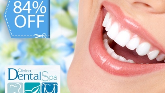 [Imagen:¡Paga Q395 en lugar de Q2,400 por Blaqueamiento Láser + Pulido  Dental con Profijet + Limpieza Profunda con Ultrasonido + Aplicación de Flúor + Examen Completo y Evaluación con Cámara Intraoral en Dental Spa!]