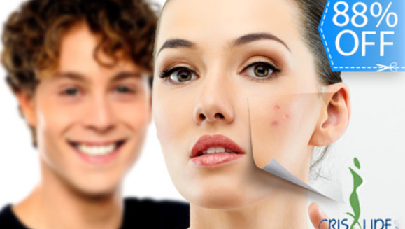 [Imagen:¡Nueva Tecnología Facial Láser!¡Paga Q249 en lugar de Q2,100 por 2 Terapias Faciales Láser (Anti-Acné, Anti-Aging ó Anti-Manchas)  + 2 Mascarillas Personalizadas + Examen Diagnostico Profesional en Crisalide MD!]