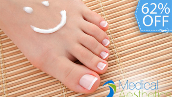 [Imagen:¡Paga Q95 en lugar de Q250 por Pedicure Clínico que incluye: Exfoliación, Limado y Recorte de Uñas, Eliminación de Callosidades, Aplicación de Crema con Suero de Hidratación, Masaje Descongestivo y Esmaltado Gelish en Medical Aesthetics!]