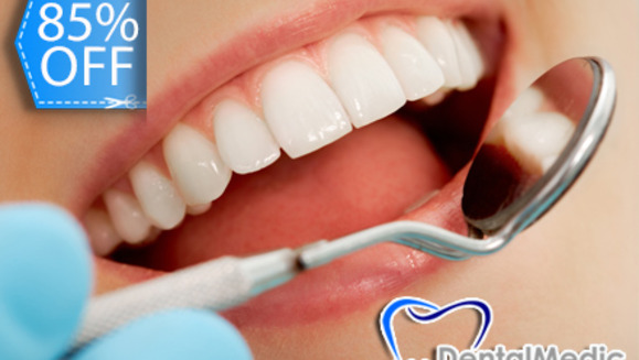 [Imagen:¡Paga Q85 en lugar de Q550 por Limpieza Dental Completa que incluye: Desmanchado Dental con Profijet + Eliminación de Sarro y Placa con Ultrasonido + Aplicación Tópica de Flúor + 2 Radiografías Digitales + Examen Diagnóstico en DentalMedic!]