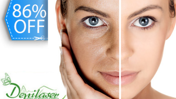 [Imagen:¡Paga Q99 en lugar de Q700 por Paquete de Limpieza, Hidratación Intensiva, Rejuvenecimiento y Anti Manchas que incluye: Peeling Hidratante Celular + Vaporización de Ozono + Altafrecuencia y Más en Depilaser!]