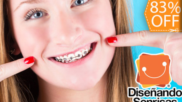 [Imagen:¿Quién más quiere dientes perfectamente alineados? ¡Paga $95 en lugar de $550 por Colocación de Mini-Brackets Metálicos en Diseñando Sonrisas!]