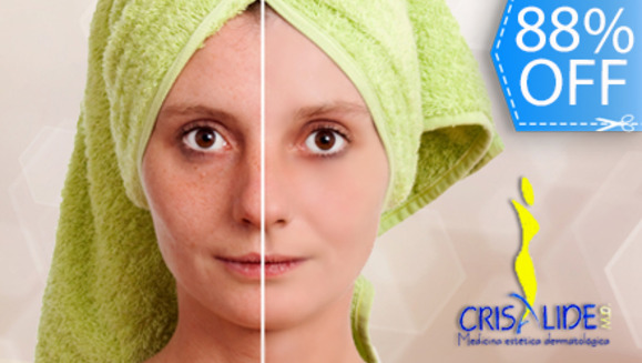 [Imagen:¡Paga Q99 en vez de Q850 por Limpieza Facial Clínica con: Peeling Hidratante con Ácido Lactobiónico + Vaporización de Ozono + Extracción de Puntos + Alta Frecuencia + Electroporación con Aceites según Tipo de Piel + Mascarilla Personalizada y Más!]