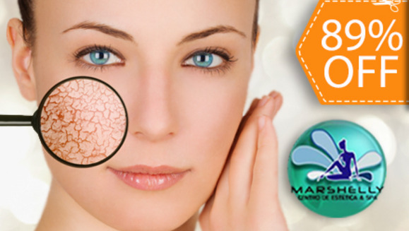 [Imagen:¡Paga $49 en vez de $465 por 1 Microdermoabrasión con punta de diamante + Inyectaje de Ácido Hiáluronico + 1 Mallado de Colágeno y más en Marshelly!]
