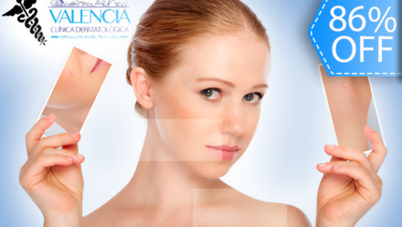 [Imagen:¡Paga Q195 en vez de Q1,400 por Paquete Facial Anti Acné de 11 Tratamientos que incluye: 2 Microdermoabrasiones + 1 Peeling + 1 Sesión de Luz LED y  Mucho Más en Valencia Clínica Dermatológica!]
