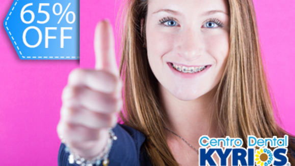[Imagen:¡Paga Q695 en lugar de Q1,980 por Colocación de Brackets Metálicos + Profilaxis + Eliminación de Sarro + Evaluación + Aplicación de Flúor en Centro Dental Kyrios!]