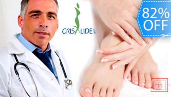 [Imagen:¡Deshazte de los Hongos en la Uñas de una Sola Vez!¡Paga Q185 en lugar de Q1,050 por Tratamiento Láser para Hongos en las Uñas + Examen Diagnóstico por Médico Especializado en Crisalide!]