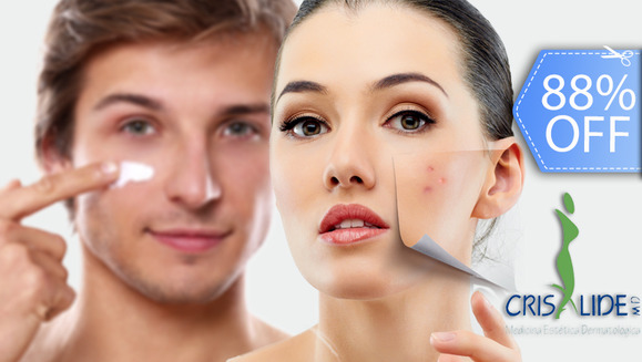 [Imagen:¡Nueva Tecnología Facial Láser! ¡Paga Q249 en lugar de Q2,100 por Terapia Facial Láser (Anti-Acné, Anti-Aging ó Anti-Manchas) + 2 Mascarillas Personalizadas + Examen Diagnostico Profesional en Crisalide MD!]