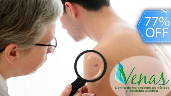 [Imagen:¡Paga Q149 en vez de Q650 por Eliminación Láser de Hasta 5 Lunares, Cabezas de Vena o Arañitas Faciales + Evaluación Profesional en Venas Guatemala!]