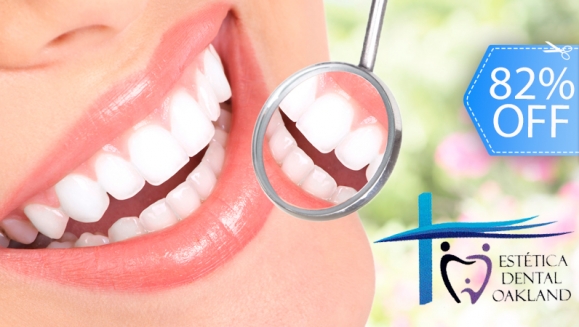 [Imagen:¡Paga Q259 en vez de Q1,450 por Paquete Dental que Incluye: 2 Rellenos ó 4 Sellantes + Limpieza con Ultrasonido + Pulido Dental con Profijet + Aplicación de Flúor + 2 Radiografías + Examen Diagnostico con Cámara Intraoral en Estética Dental Oakland!]