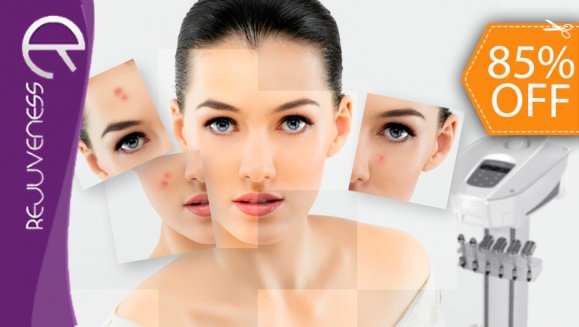 [Imagen:¡Paga $90 en lugar de $590 por Tratamiento Facial contra Acné, Manchas y Envejecimiento que Incluye: 4 Limpiezas Especializadas, 4 Sesiones de Luz Led con DERMAMAX Y 4 Tratamientos para Cicatrizar Brotes Inflamados en Rejuveness Center!]