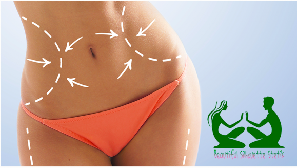 [Imagen:¡Paga Q299 en lugar de Q5,900 por Liposucción sin Cirugía de 120 tratamientos: 30 Mesoterapias + 20 Masajes Escultores + 10 Ultracavitaciones + 10 Lipoláser + 20 Electroterapias + 10 Vendas Termoactivas + 10 Vibroterapias + 10 Detox y Más!]
