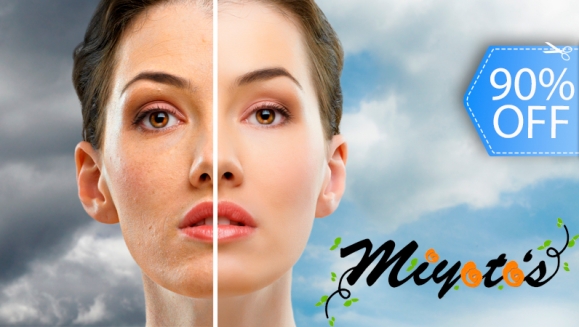 [Imagen:¡Paga Q275 en lugar de Q2,800 por Limpieza Facial Profunda + 4 Sesiones de Microdermoabrasión + 4 Alta Frecuencias + 4 Terapias de Luz Led + 4 Mascarillas + 4 Aplicaciones de Bloqueador Solar + Masaje Cráneo Facial en Miyotos!]