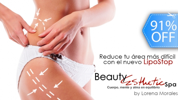 [Imagen:¡Paga Q599 en lugar Q6,500 por Paquete Reductivo LipoStop que Incluye: 4 Masajes Reductores + 3 Lipoláser + 3 Power Plate + 3 Algasculptor + 3 Masajes Drenantes Linfáticos + 4 Ozonoterapias + Supervisión Nutricional y Más en Beauty Esthetic.]