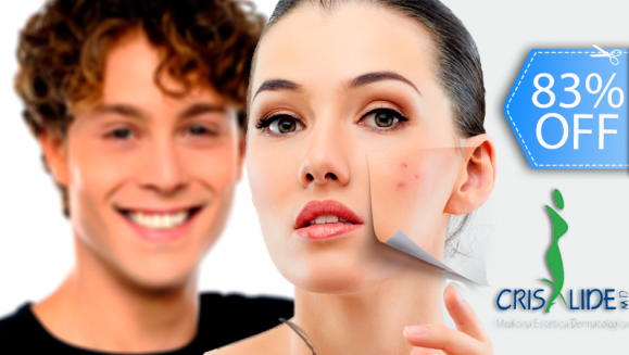 [Imagen:¡Paga Q135 en lugar de Q800 por Paquete Facial Anti-Acné ó Anti-Manchas que Incluye: Peeling Personalizado + Microdermoabrasión con Punta de Diamante + 2 Altas Frecuencias + 2 Mascarillas Anti-Acné ó Anti-Manchas + 2 Hidrataciones en Crisalide!]